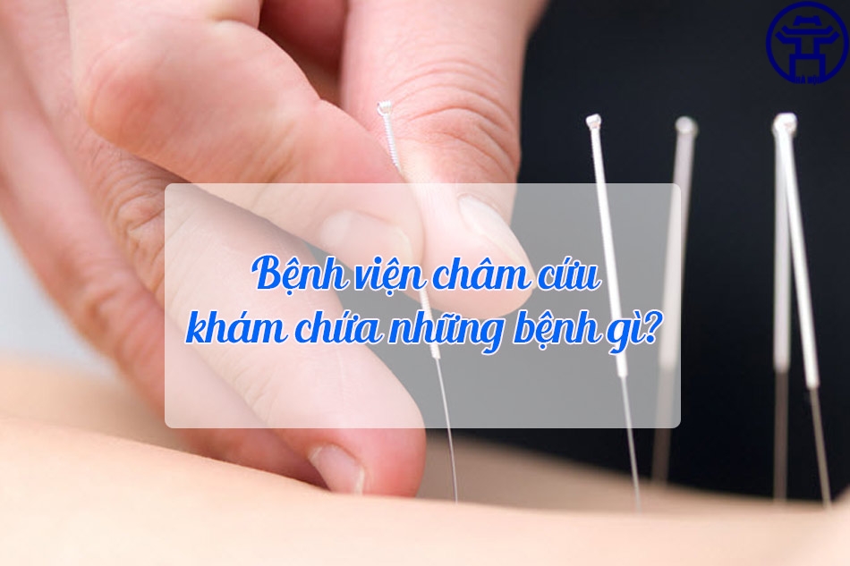 Bệnh viện sử dụng phương pháp châm cứu chữa các bệnh lý khó, hỗ trợ bệnh nhân hồi phục nhanh sau phẫu thuật