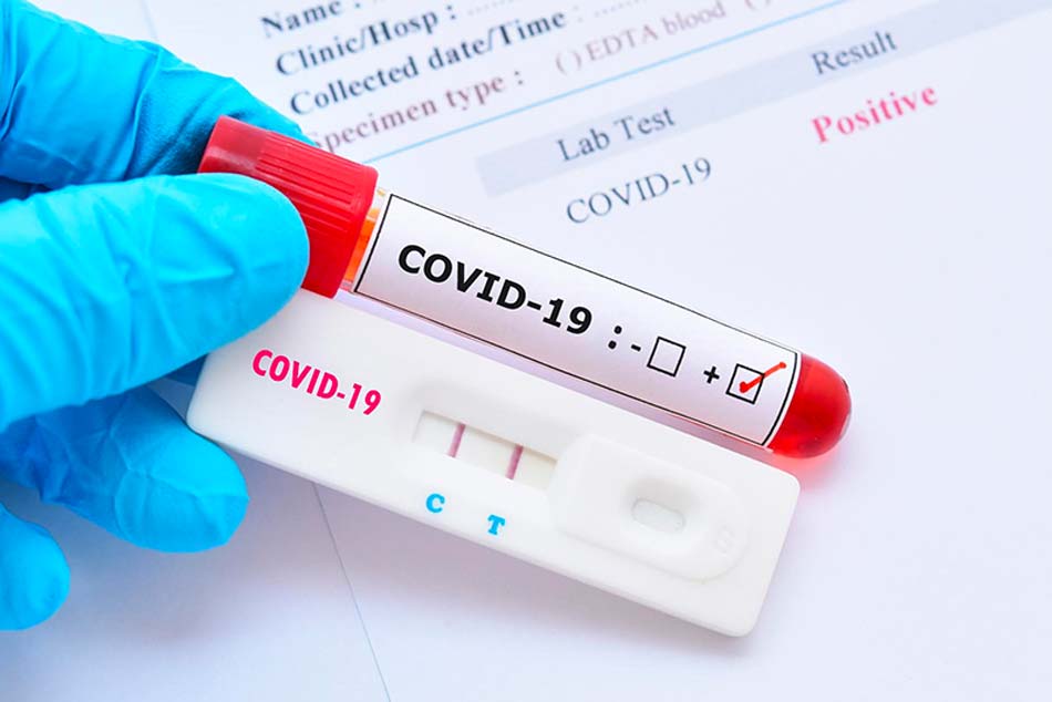 Xét nghiệm Covid-19 ở đâu tại Hà Nội? Địa chỉ, giá dịch vụ