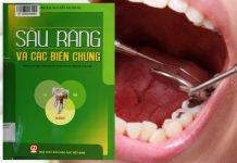 Sâu răng và các biến chứng