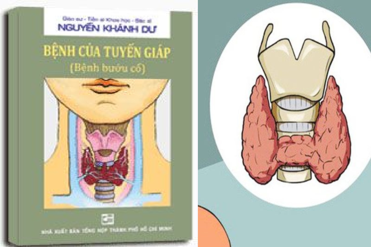 [TẢI PDF MIỄN PHÍ] Bệnh Của Tuyến Giáp (Bệnh Bướu Cổ) – MyHanoi