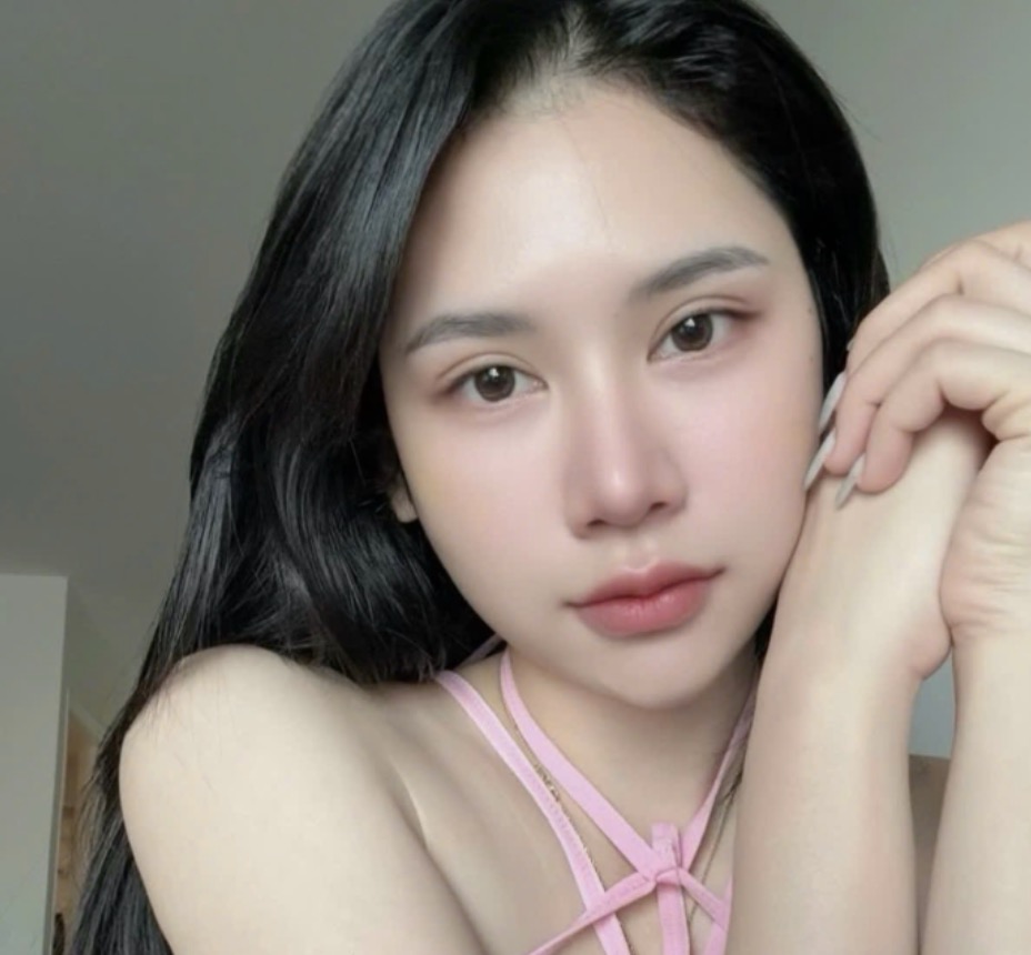 C&aacute;c yếu tố quyết định cắt m&iacute; mắt bao nhi&ecirc;u tiền