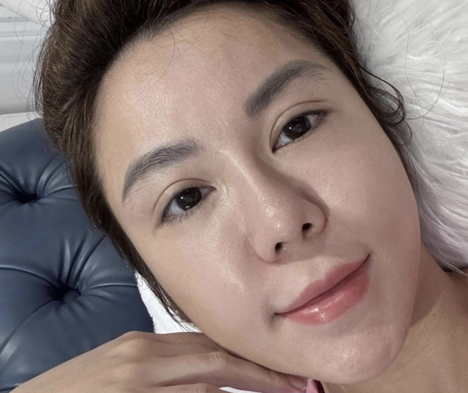 Ph&acirc;n t&iacute;ch chi tiết cắt m&iacute; mắt bao nhi&ecirc;u tiền